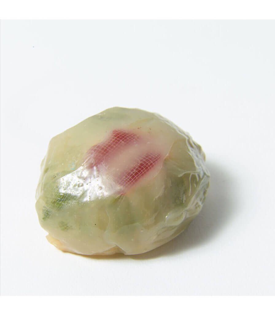 Tumeur (Tumor)
